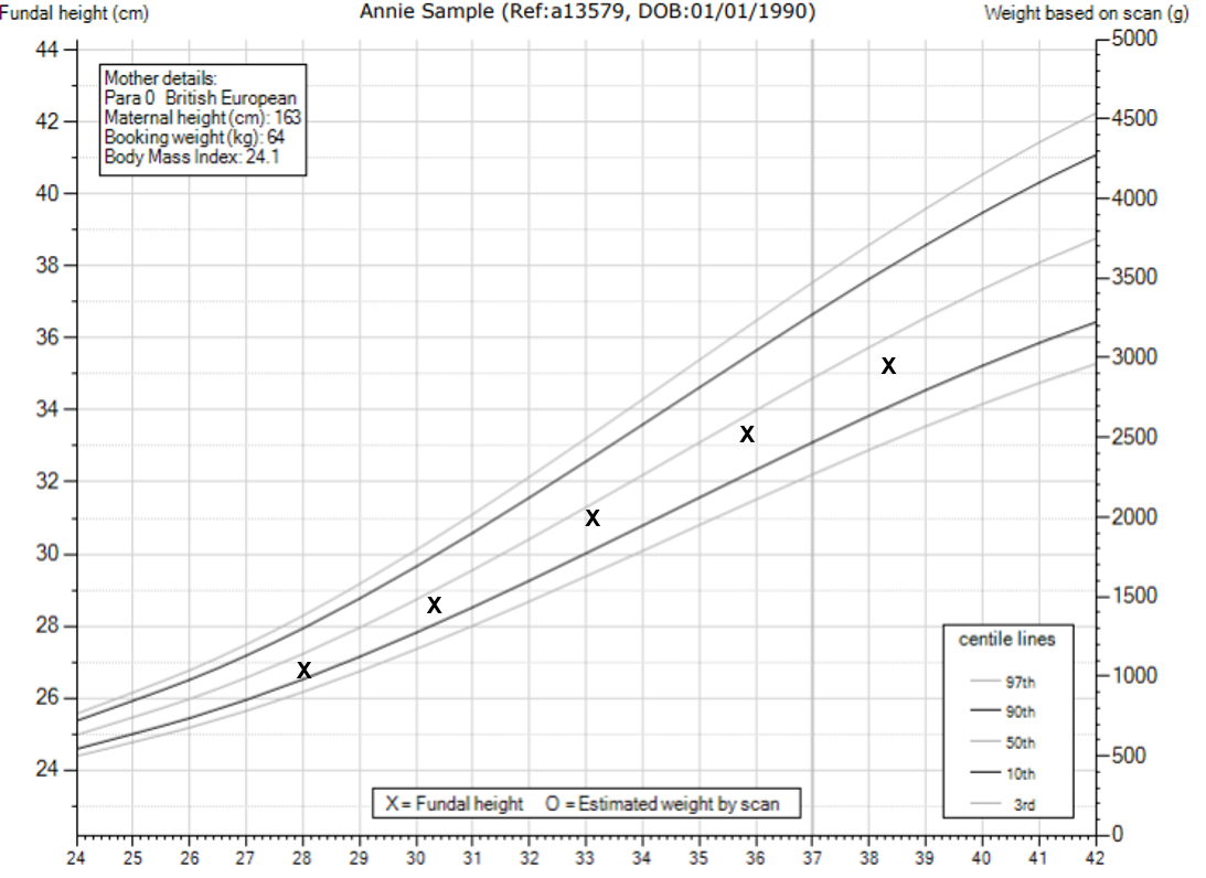 perinatal-institute-fetalgrowth